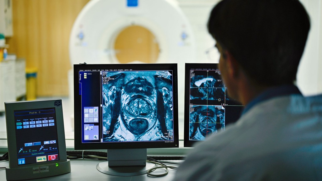 Ein Mitarbeiter untersucht medizinische Aufnahmen eines Krebspatienten